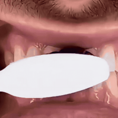 GlowDent Λευκαντική οδοντόκρεμα